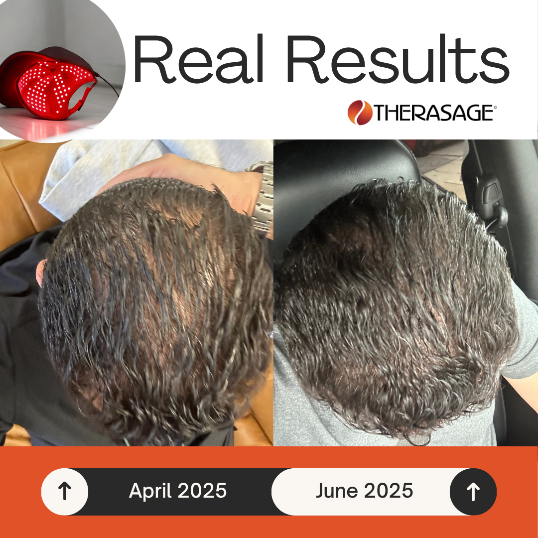 TheraCap Red Light Therapy Hair & Scalp Device — Triad Light Technology with 180 LEDs for Hair Growth and Scalp Health