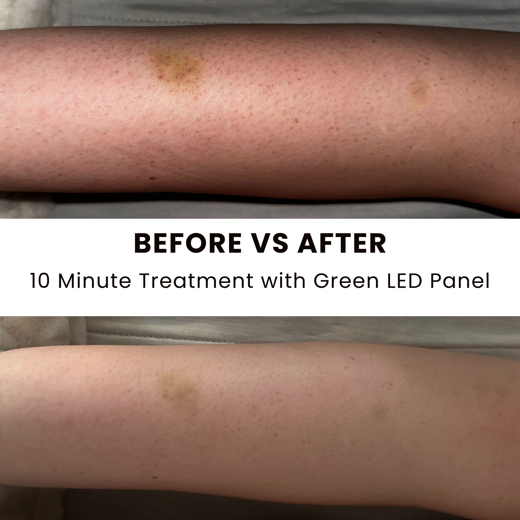 Lumara Illuminate Green Light Therapy Panel | 1,800 LED Skin Tone Support Device